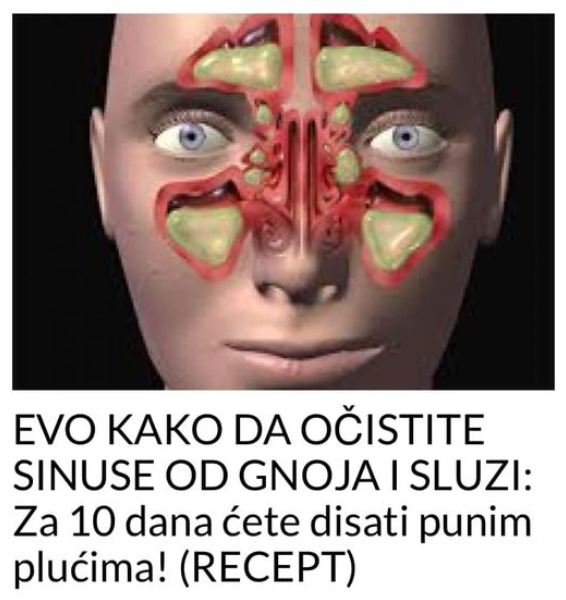 EVO KAKO DA OČISTITE SINUSE OD GNOJA I SLUZI: Za 10 dana ćete disati punim plućima!